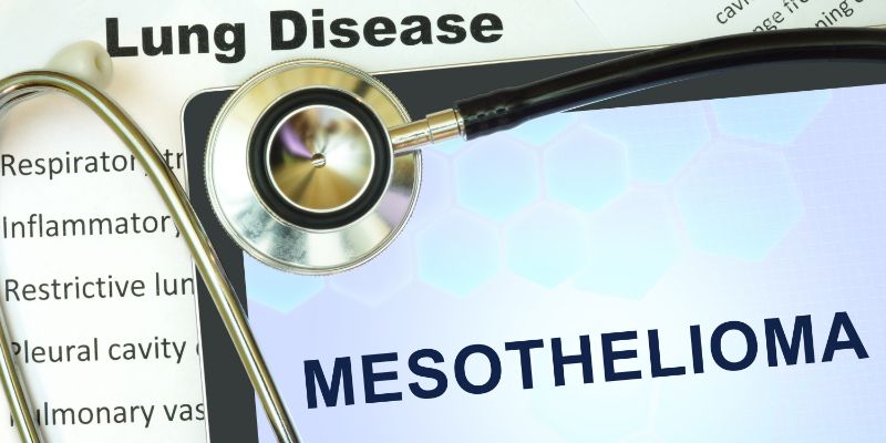 How long does a mesothelioma claim take?